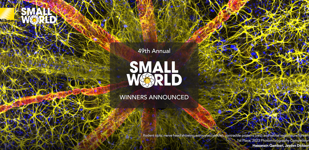 Nikon Small World Competition: Illinois Researchers Featured